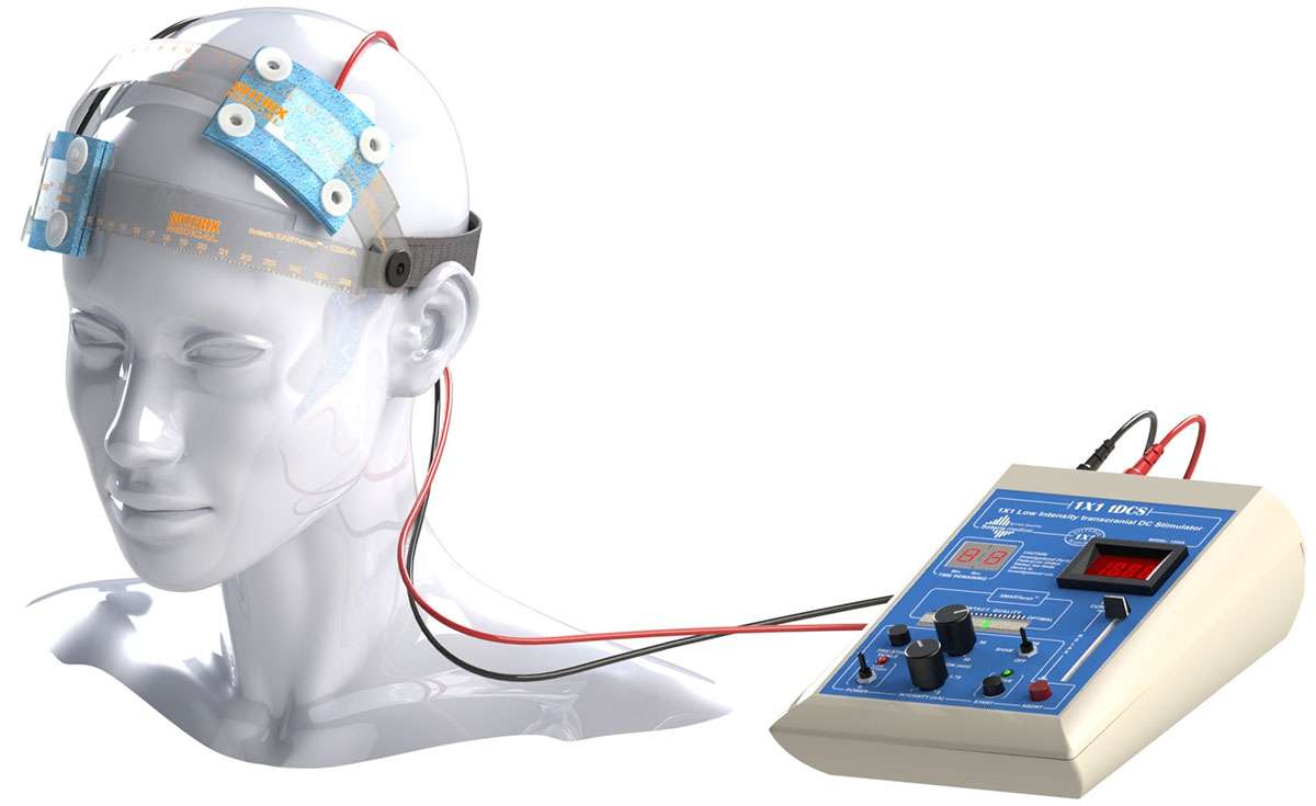 tDCS ajustimulatsioon